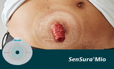 Is your stoma on a regular area?