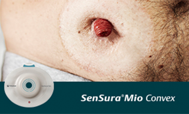 Is your stoma on an inward area?